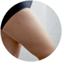 CoolSculpting-thigh